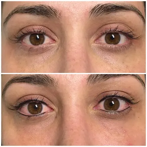 Primer plano mujer línea inferior hechas por kimberly cala en bucaramanga